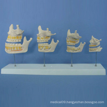 Human Tooth Growth Process Anatomy Model for Teaching (R080102)